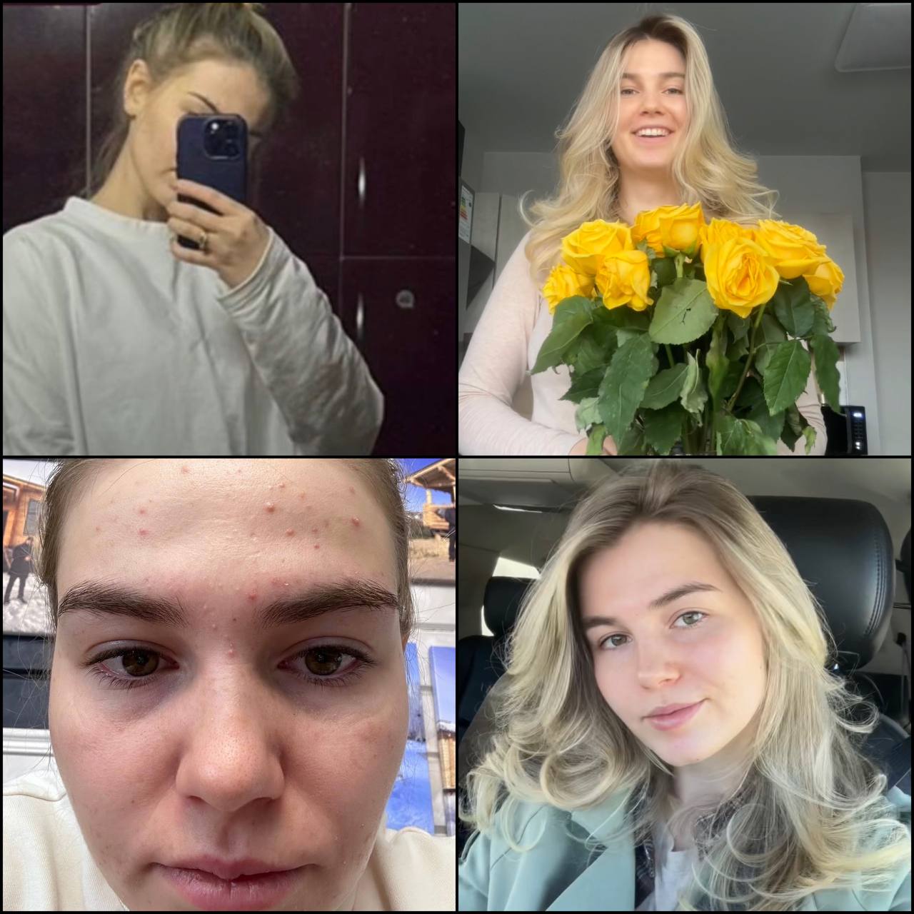 Юля — до и после